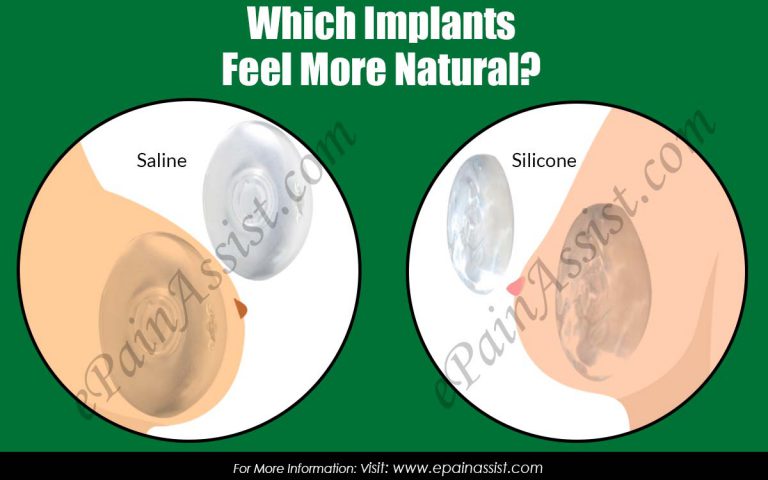 Which Implants Feel More Natural?