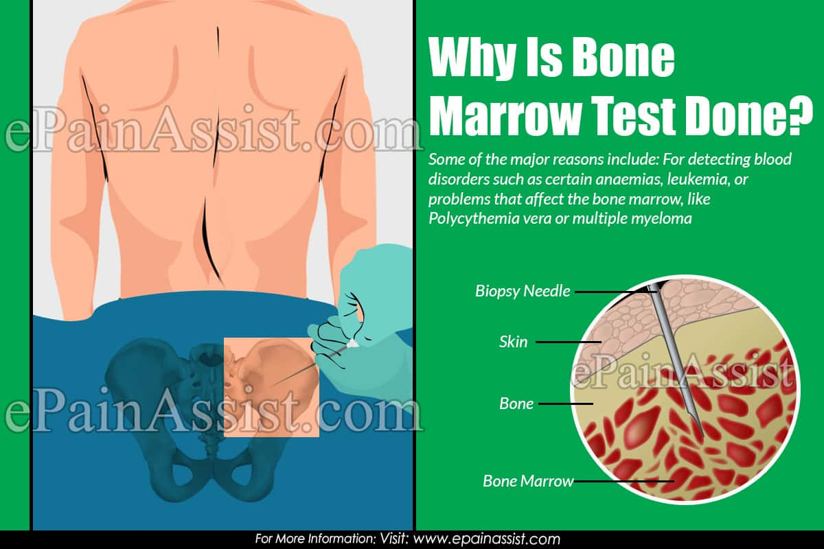 Why Is Bone Marrow Test Done?