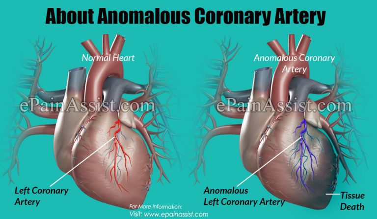 What is an Anomalous Coronary Artery Intervention & How is it Done?