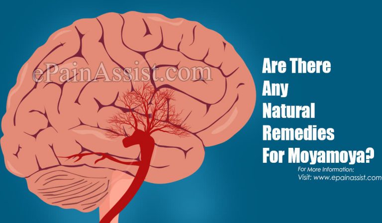 Are There Any Natural Remedies For Moyamoya?