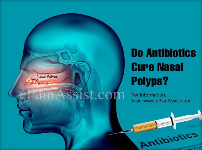 Do Antibiotics Cure Nasal Polyps?