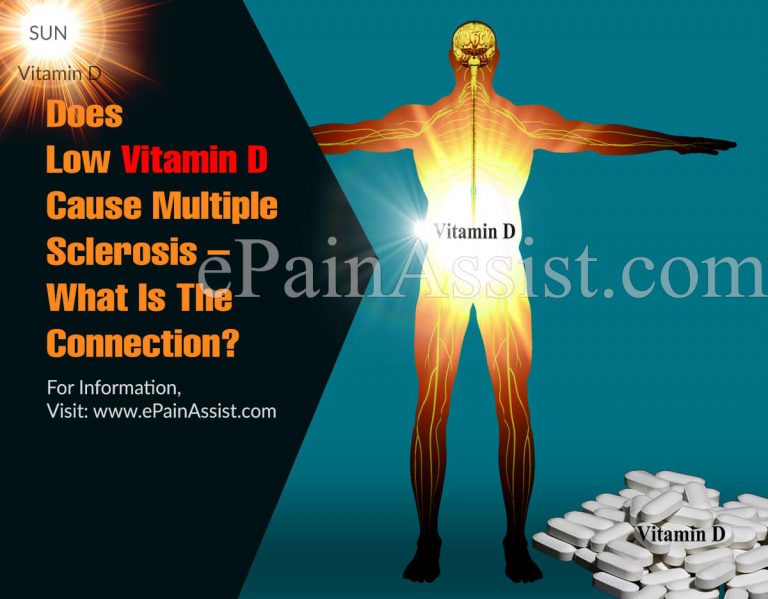 Does Low Vitamin D Cause Multiple Sclerosis – What Is The Connection?