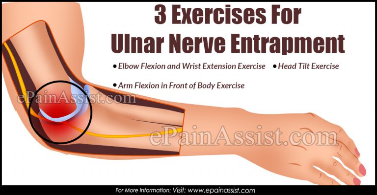 3 Exercises For Ulnar Nerve Entrapment