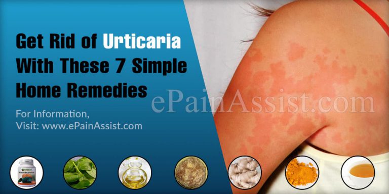 Get Rid of Urticaria With These 7 Simple Home Remedies