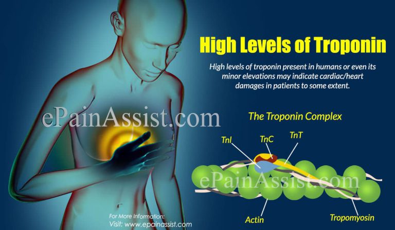 What Causes High Levels of Troponin?