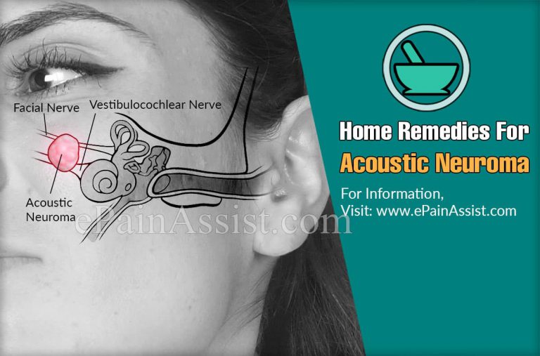 Home Remedies For Acoustic Neuroma