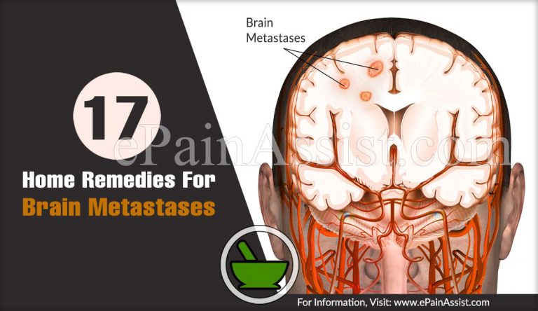 Home Remedies For Brain Metastases