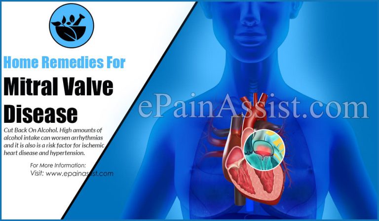 Home Remedies For Mitral Valve Disease