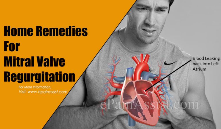 Home Remedies For Mitral Valve Regurgitation