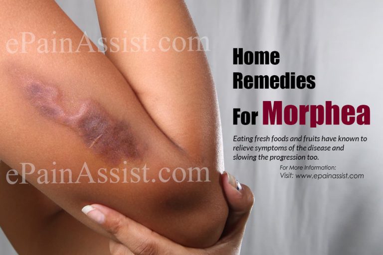 Home Remedies For Morphea