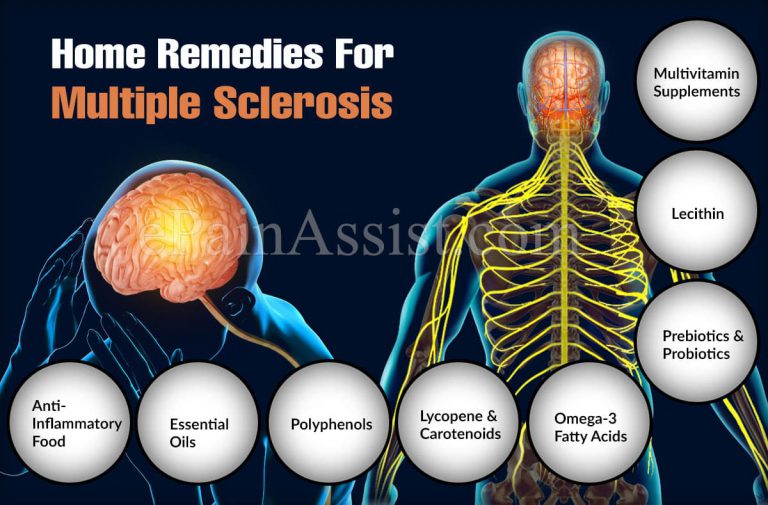 Home Remedies For Multiple Sclerosis
