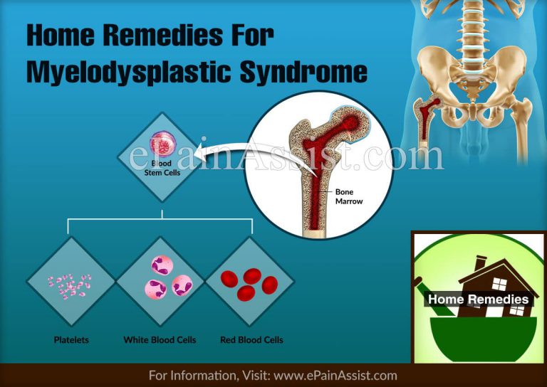 Home Remedies For Myelodysplastic Syndrome