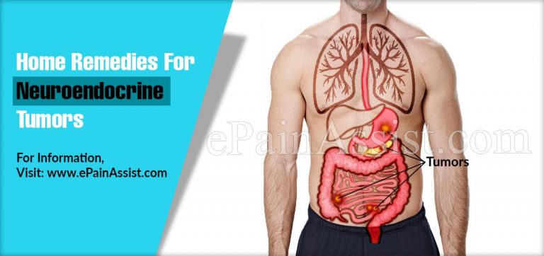 Home Remedies For Neuroendocrine Tumors
