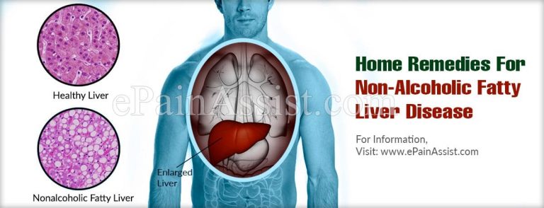 Can Nonalcoholic Fatty Liver Disease Go Away On Its Own & What Are It’s Natural Remedies?