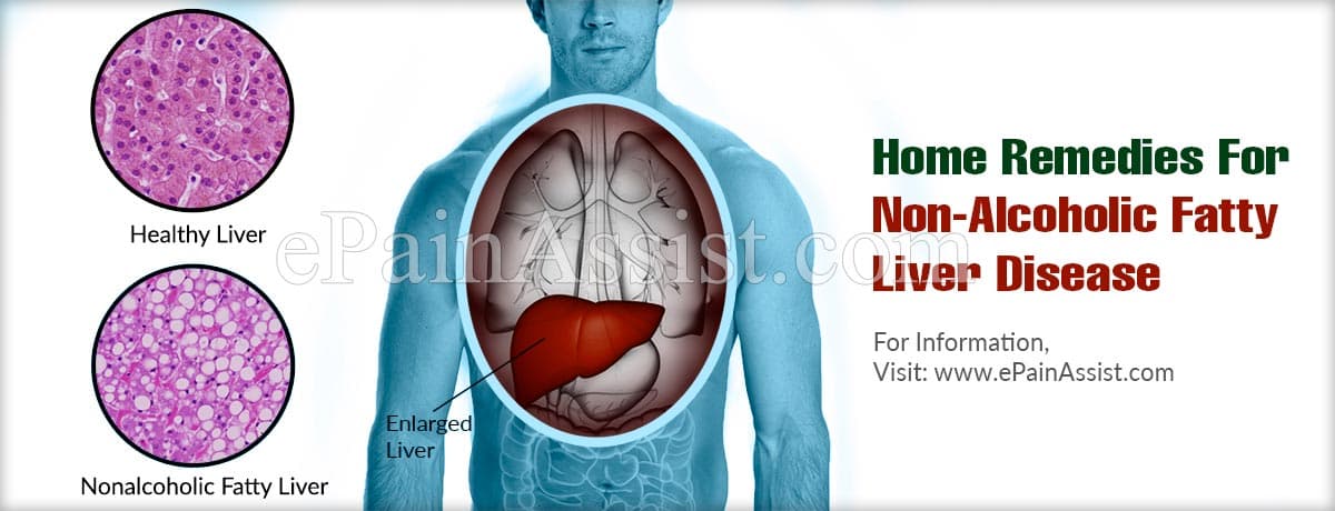 Home Remedies For Non-Alcoholic Fatty Liver Disease