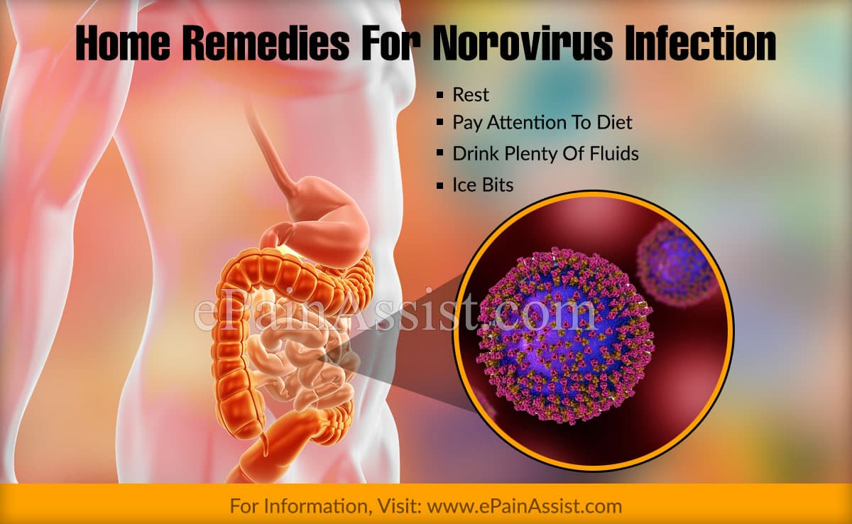 Home Remedies For Norovirus Infection