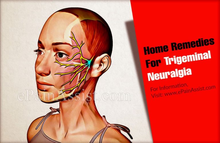 Home Remedies For Trigeminal Neuralgia