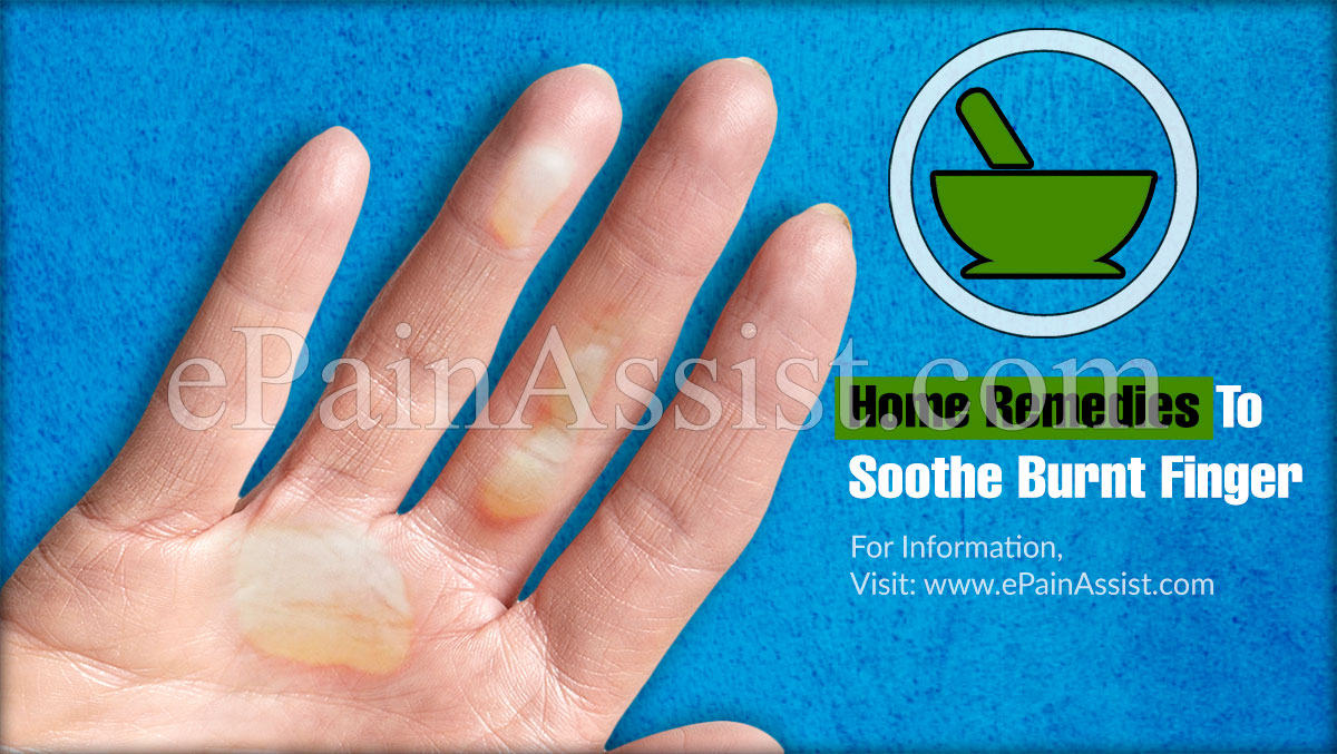 10 Home Remedies To Soothe Burnt Finger