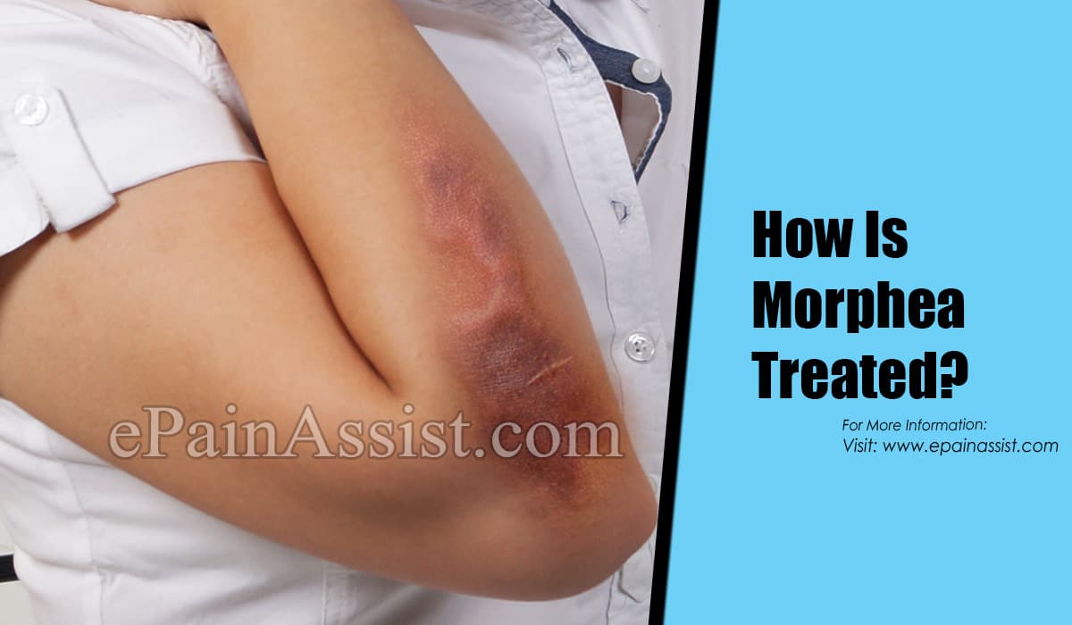 How Is Morphea Treated?