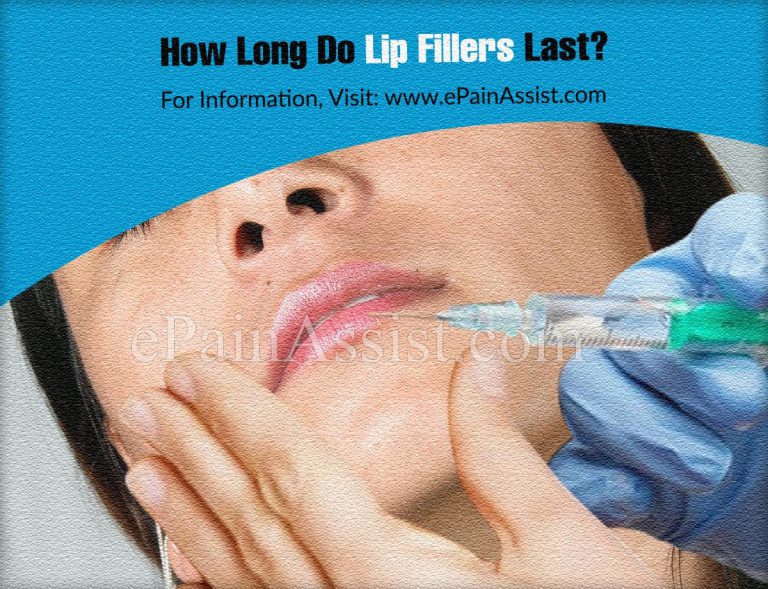 How Long Do Lip Fillers Last?