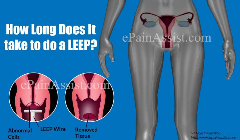 How Long Does It take to do a LEEP?