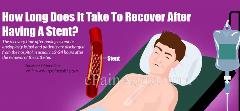 How Long Does It Take To Recover After Having A Stent?
