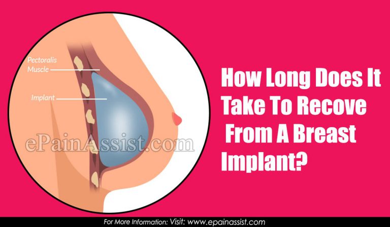 How Long Does It Take To Recover From A Breast Implant?