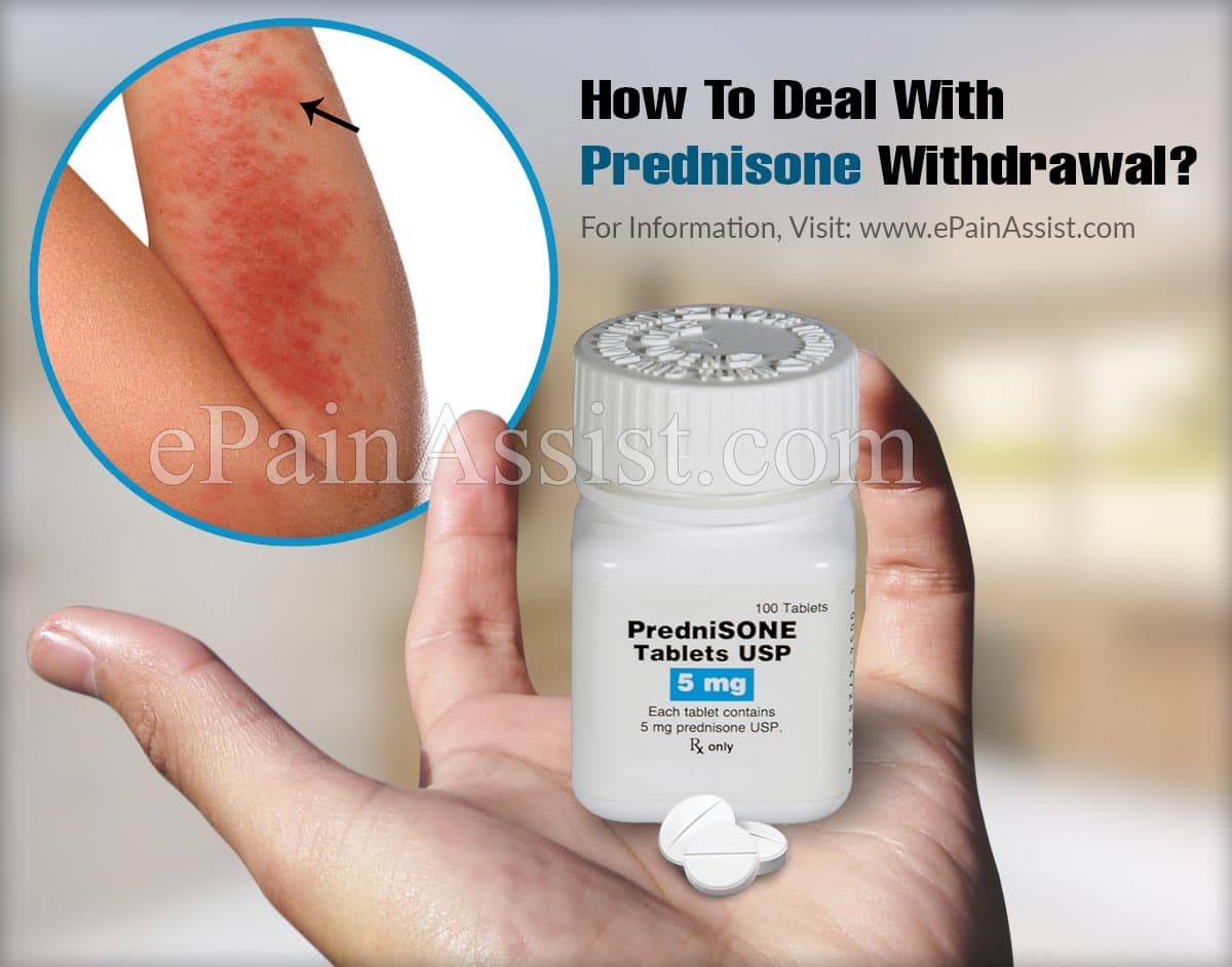 How To Deal With Prednisone Withdrawal?