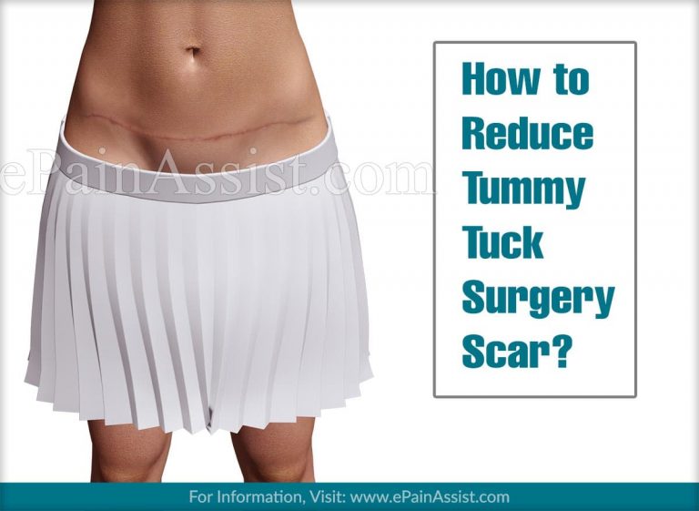 How to Reduce Tummy Tuck Surgery Scar?