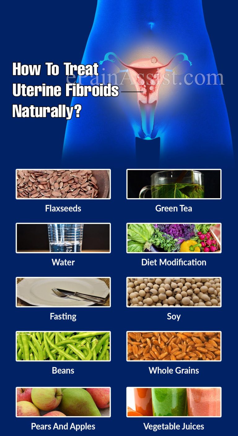 How To Treat Uterine Fibroids Naturally?
