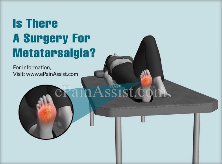 Is There A Surgery For Metatarsalgia?