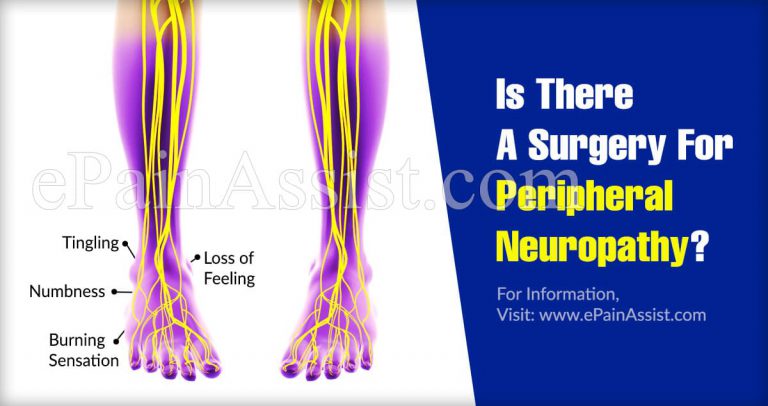 Is There A Surgery For Peripheral Neuropathy?