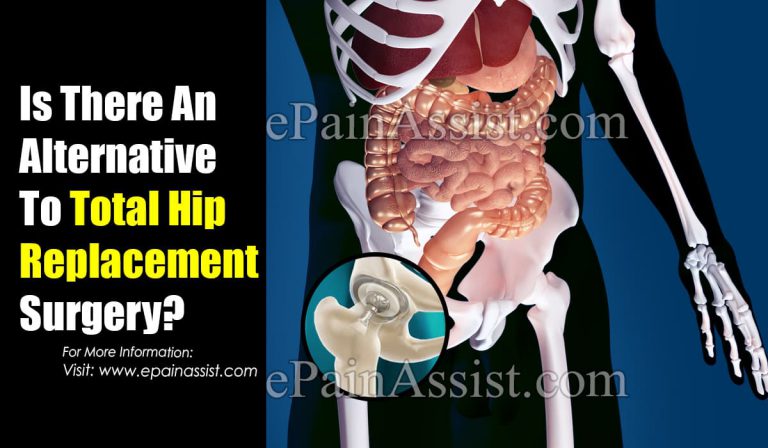 Is There An Alternative To Total Hip Replacement Surgery?