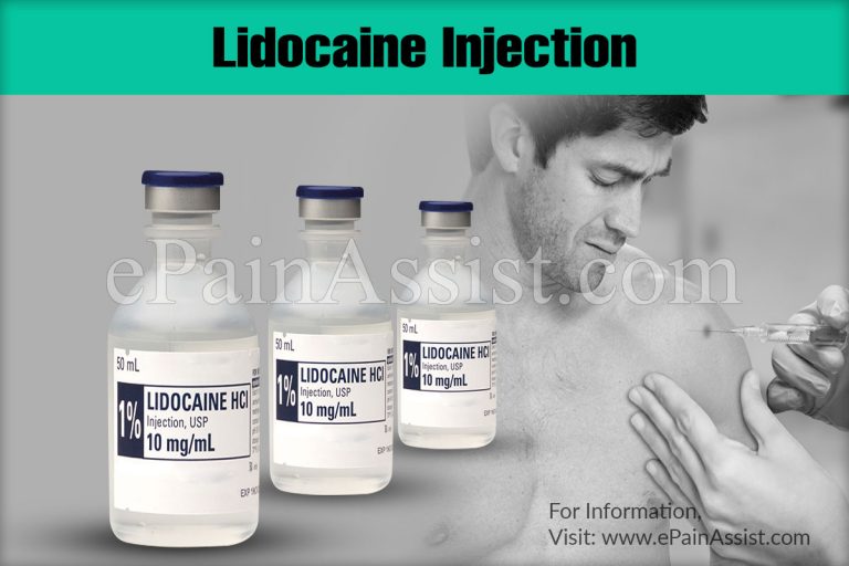 Lidocaine Injection
