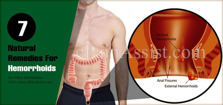 7 Natural Remedies For Hemorrhoids