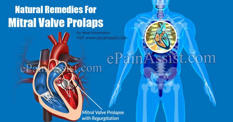Natural Remedies For Mitral Valve Prolapse