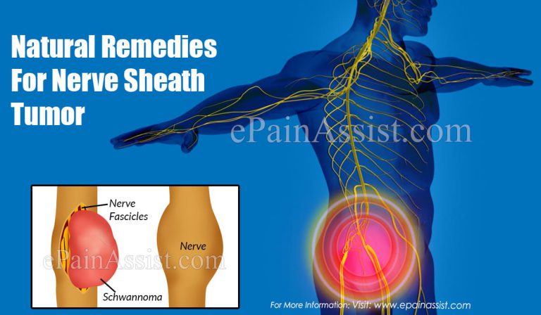 Natural Remedies For Nerve Sheath Tumor
