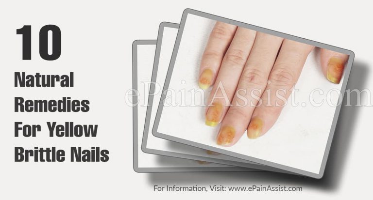10 Natural Remedies For Yellow Brittle Nails