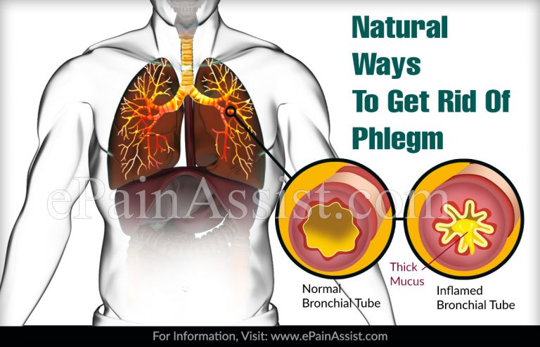 Natural Ways To Get Rid Of Phlegm