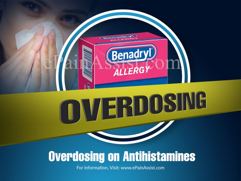 Overdosing on Antihistamines – Is It Possible?