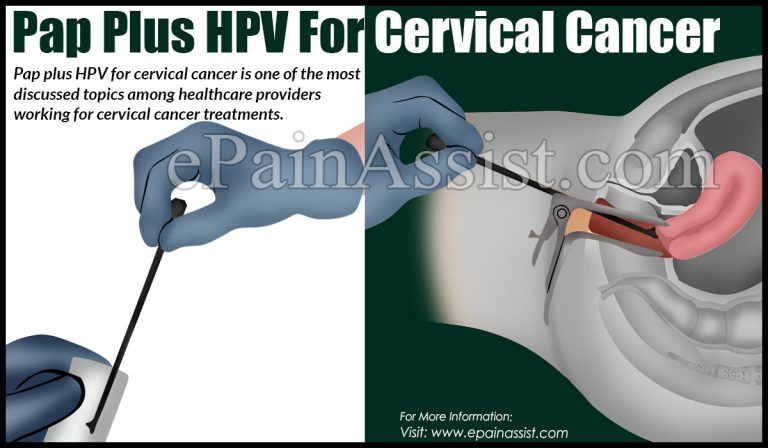 Pap Plus HPV For Cervical Cancer – Why Co-Testing In Cervical Cancer Is Better?