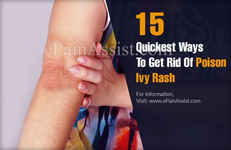 15 Quickest Ways To Get Rid Of Poison Ivy Rash