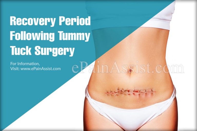 Recovery Period Following Tummy Tuck Surgery & Tips to Recover Faster