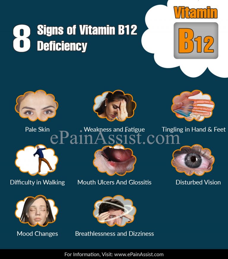 8 Signs of Vitamin B12 Deficiency
