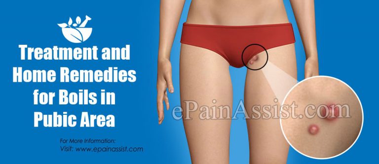 Treatment and Home Remedies for Boils in Pubic Area