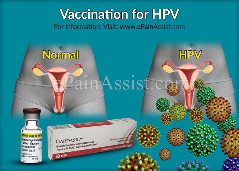 HPV: Causes, Vaccination, Treatment,  Prevention, Prognosis