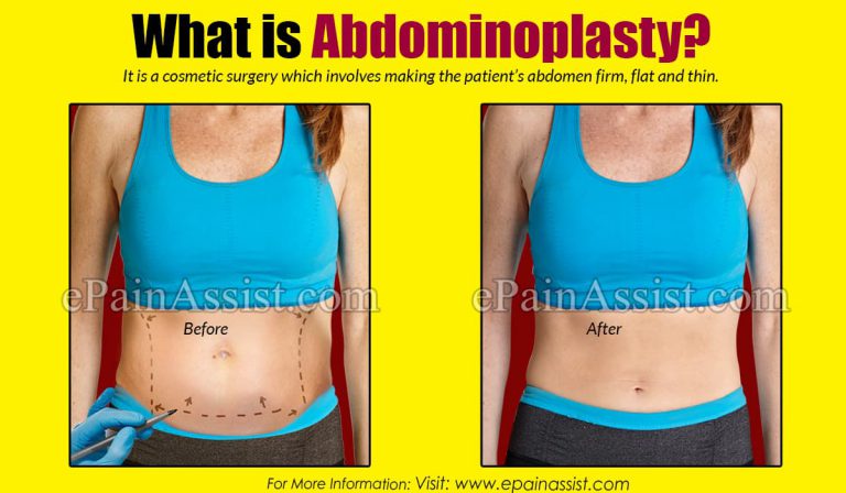 Abdominoplasty|Suitable Candidate|Risks|Results& Outcomes