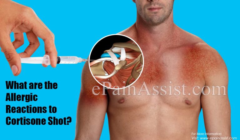 What are the Allergic Reactions to Cortisone Shot?