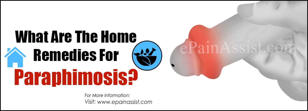 What Are The Home Remedies For Paraphimosis?