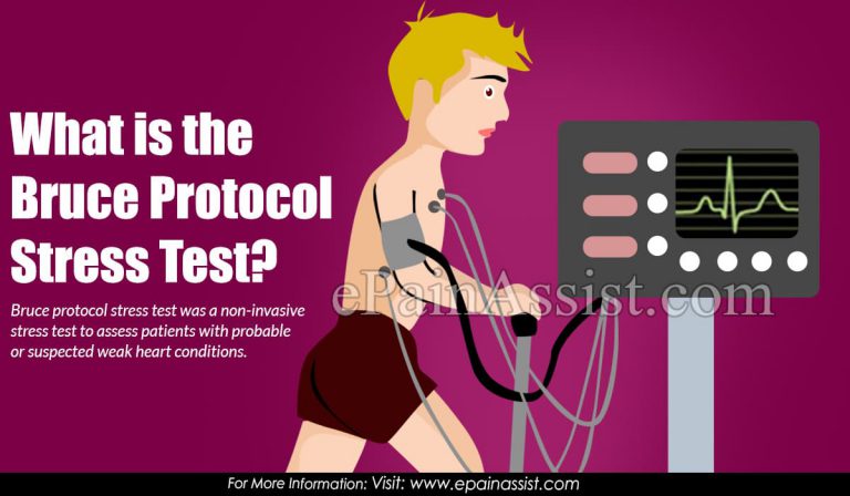 What is the Bruce Protocol Stress Test?